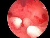 2026年江西省妇幼三代试管技术如何？大概要花费多少钱？