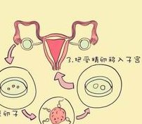 湘雅医院做试管婴儿怎么样？